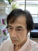 完全オーダーメイドウイッグ装着前before「完全オーダーメイドウイッグ」