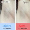 「ホームページに「脱毛経過・Before After」のページが誕生！！」
