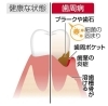 出展  東京新聞「歯周病が全身の病気を引き起こすって本当？  フェアリ歯科です」