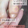 「フットケア【福井市/ネイル/魚の目除去】」