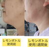 実際にレモンボトル使ってみた「新しい痩身メニューのレモンボトル」