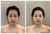 韓国式コルギ「【フェイスラインが変わる】秋こそ“コルギデビュー”」