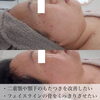 「このような方におすすめ！韓国トリプルハイフ【福井ハイフ/福井エステ/福井フェイシャルエステ/福井小顔】」