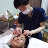 美顔鍼