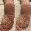 足裏角質ケア（60分）