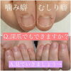 「爪で悩める方々に...☆【美爪を追求★ケア重視/福井のネイルサロン】」