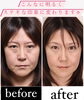 「【たるみ・シワ】改善への近道ありますよ！若返る喜びを実感ください♪」