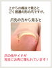 かくれ巻き爪さん⁈「【巻き爪】気づいてないだけかも⁈」