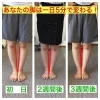 O脚矯正マシン(1ヶ月使い放題)