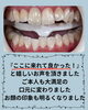 「30代からの若見えには口元の清潔感がカギ！笑顔を明るく彩るメディカルホワイトニング」