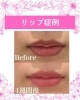 Romapink | 食いしばりケア＆ホワイトニング専門店 お口の整体