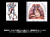 心膜から横隔膜の接続「【リハビリ】肩こりと呼吸」