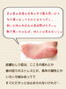 ひそかに気になってる方、いらっしゃいませんか？「【皮膚むしり症】気になっている方へ【フットケア】」