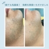 「salon de epila　脱毛器のご紹介【トリコカワグチ掲載店の最新情報】」