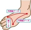 足の裏はこの3つのアーチが大切です。「「偏平足」そのままにするなっ!甘く見ていると後で痛い目に…。」