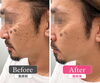 「男性もシミケアを始める時代！」