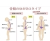 骨盤のゆがみも色々あります🫣「今年のゆがみは今年のうちにリセットしましょ✨」