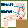 画像3「巻肩の原因は？」