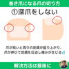 巻き爪になる爪の切り方①「巻き爪を予防！正しい爪の切り方【外反母趾や巻き爪、足の悩み専門整体/千葉県船橋市西船徒歩2分】」