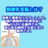 胸鎖乳突筋とは「胸鎖乳突筋」