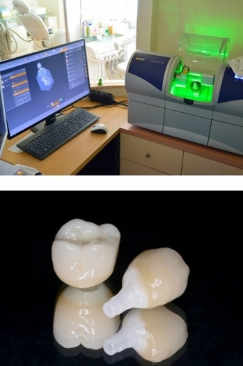 最新の機器を導入し患者さんの時間短縮や負担軽減に努めています「熊澤歯科クリニック」