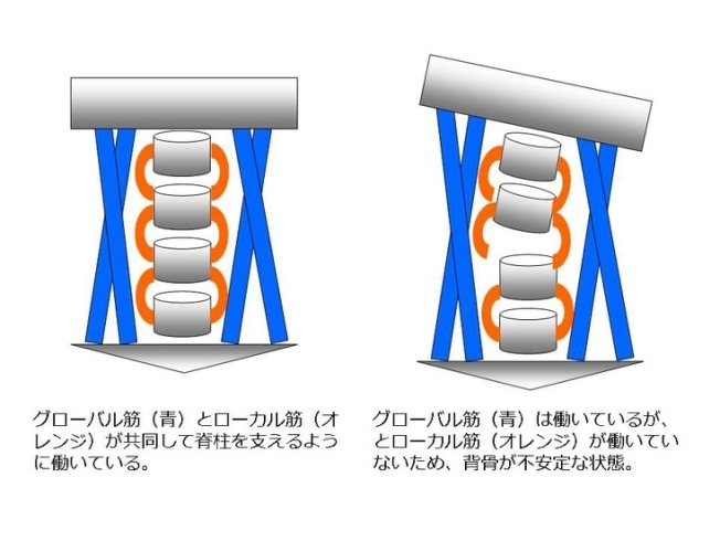 ローカル筋とグローバル筋の関係　インナーが大切です「一体何の筋肉だぁ？　　　　　　　　　　　　　　「ローカル筋」と「グローバル筋」」