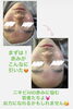 ニキビ肌も改革始めよ！「（募集おわり）お久しぶりの♡モニター募集です😌」