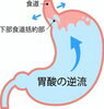 食べてすぐ横になると胃酸は逆流しやすいので控えよう「逆流性食道炎による胸やけの改善に☆初回施術料5300円☆」
