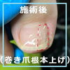 No.54根本から巻いているお爪は根本から４「No.54根本から巻いているお爪は根本からまっすぐに」