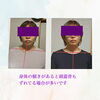 頭のぎりから鼻先を線で繋いでいます。「身体の傾きから背痛に悩まされていたお客様の話しです」