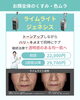 ライムライト・ジェネシス「🌿春の美白、何から始める？症状別に選べるサザクリのシミ・肝斑治療❤️‍🩹　長崎」
