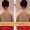 二の腕＋肩凝りと盛り肉スッキリコース　筋膜リリースで可動域UP