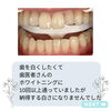 before「メディカルホワイトニング」