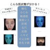 ベテランスタッフによる丁寧なカウンセリング付き「あなたの肌の奥はどうなっている？！最新AI機能の肌診断！【宮崎市エステ・リセル・肌診断・最新機械・毛穴・ニキビ・肝斑・たるみ・筋膜ケア】」