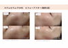 「夏バテお肌解消！「エクソソーム」&「幹細胞美容培養液」超高濃度生ヒト幹細胞美容液導入♥」