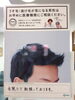 「薄毛、抜け毛が気になる方☆☆☆                              ～広島県三次市で優雅なファスティングを「もねこハウス」でしませんか！」