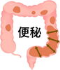 頑固な便秘から解放「「慢性的な便秘・下痢、その原因は腸のバリア機能？」」