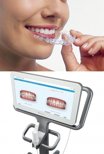 診察室に完備された口腔内スキャナーで歯並びを立体的に確認。「ステラ矯正歯科」