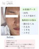 「1回で変わる顔、12回で変わる横顔＊首から整えるソニックエステ」