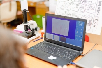 顕微鏡で映し出した毛細血管をパソコンでその場で確認「くきどめ薬局」