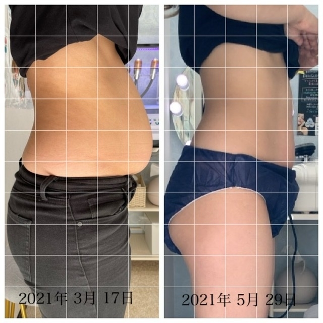 セルフエステエンリケ 清武加納店 セルフエステエンリケ 清武加納店