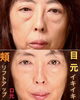 「目の下のたるみ、頬のたるみ、口元のたるみ、あらゆるたるみに効果抜群【福井エステ/たるみ/しわ/リフトアップ】」