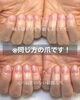 「深爪でも美爪になれる！【福井市/自爪育成/爪悩み】」