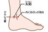 「効果的なカイロの使い方☆知ってる？(*^ーﾟ)b」
