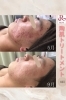 メンズ向け陶肌トリートメントコースもあります！「プメハナ プライベートエステサロン」