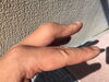 「クマ先生の左手の中指は変形しているんですね！(^◇^;)」