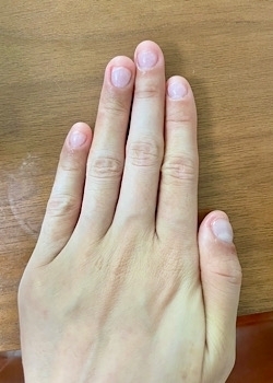 噛み癖などによる深爪の悩みご相談ください。「nail salon Aile（ネイルサロン エル）」