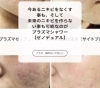「Loose【ニキビ／クレーター／ニキビ跡】でお悩みの皆様へ」