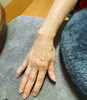 HMですっかり開く様になって良かった！「つえを使われるシニアの手事情。ハンドマッサージで・・・」