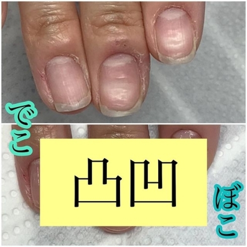 トラブル爪さんも自爪育成 福井市 ネイルサロン メディカルネイルプランナー Nail Salon Alohaloma アロハロマ のニュース まいぷれ 福井